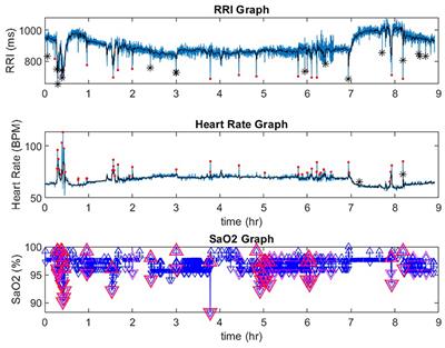 Role of automated detection of respiratory related heart rate changes in the diagnosis of sleep disordered breathing
